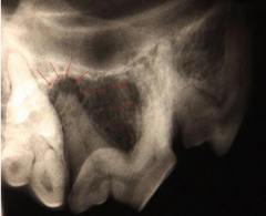 Röntgenbild vom Zahn